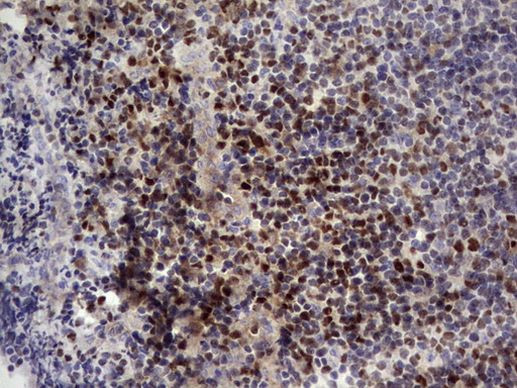 IKZF3 Antibody in Immunohistochemistry (Paraffin) (IHC (P))