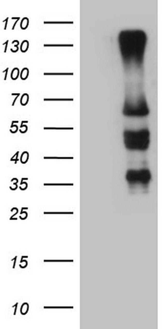IKZF3 Antibody in Western Blot (WB)