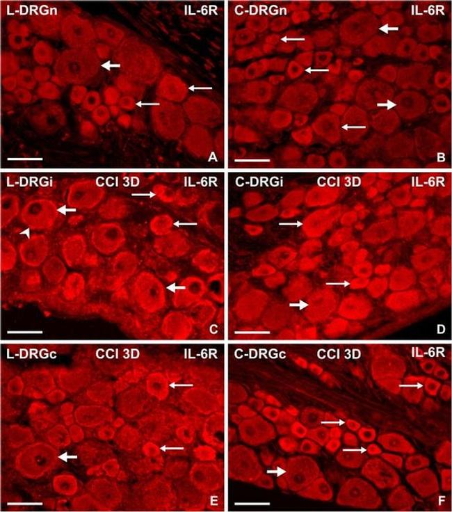 IL-6 Antibody in Immunohistochemistry (IHC)