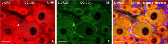 IL-6 Antibody in Immunohistochemistry (IHC)