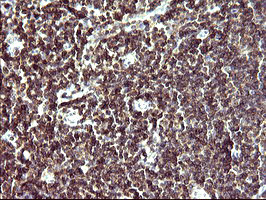 IL10RA Antibody in Immunohistochemistry (Paraffin) (IHC (P))