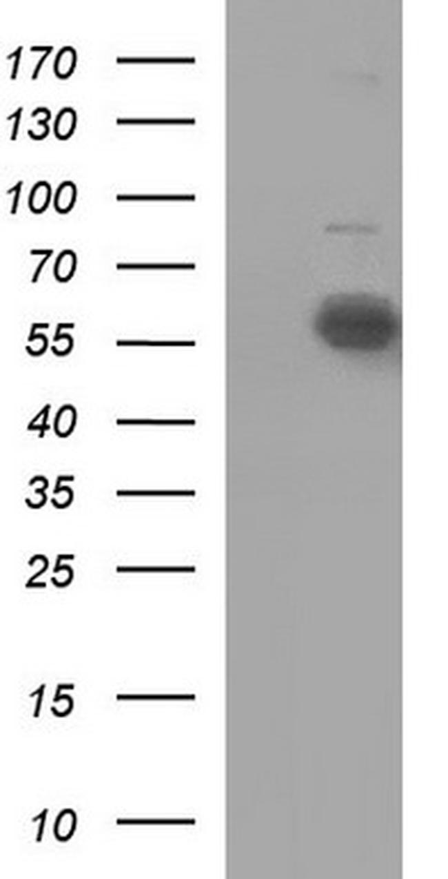IL10RA Antibody in Western Blot (WB)