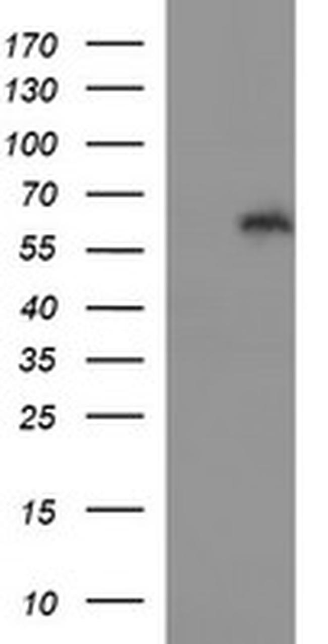 IL10RA Antibody in Western Blot (WB)