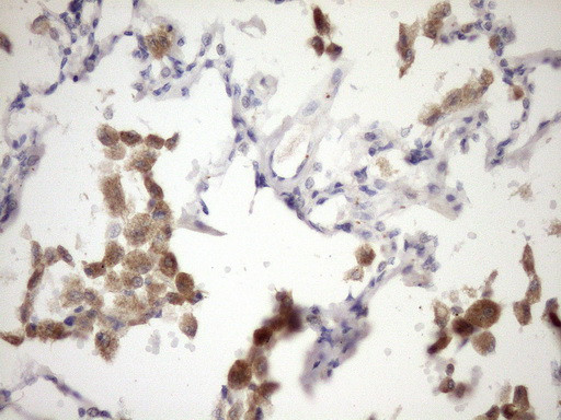 IL12A Antibody in Immunohistochemistry (Paraffin) (IHC (P))