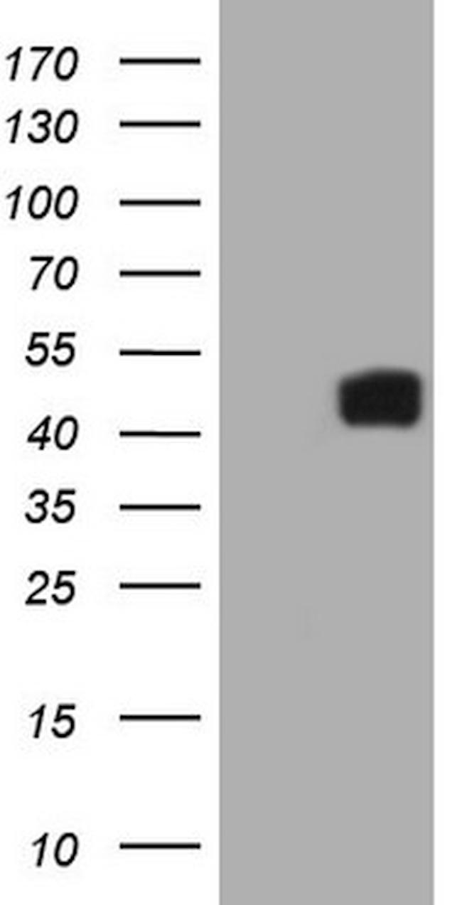 IL12B Antibody in Western Blot (WB)