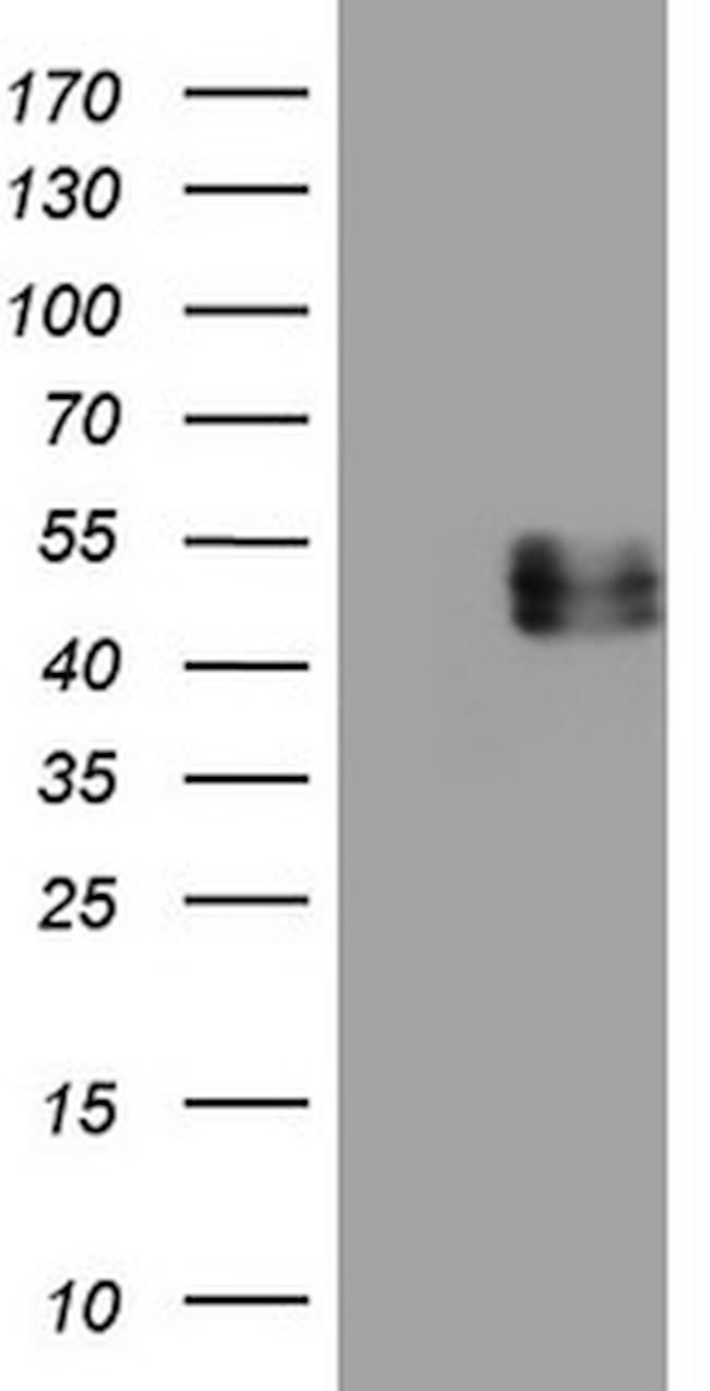 IL12B Antibody in Western Blot (WB)