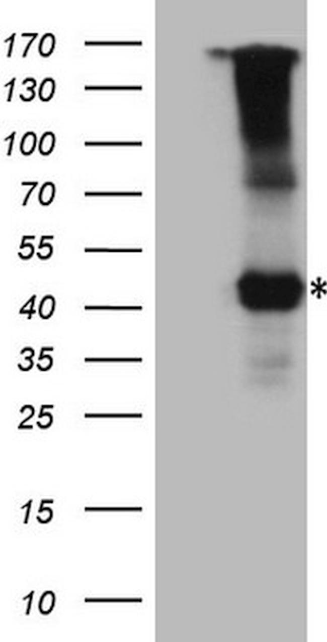 IL12RB1 Antibody in Western Blot (WB)