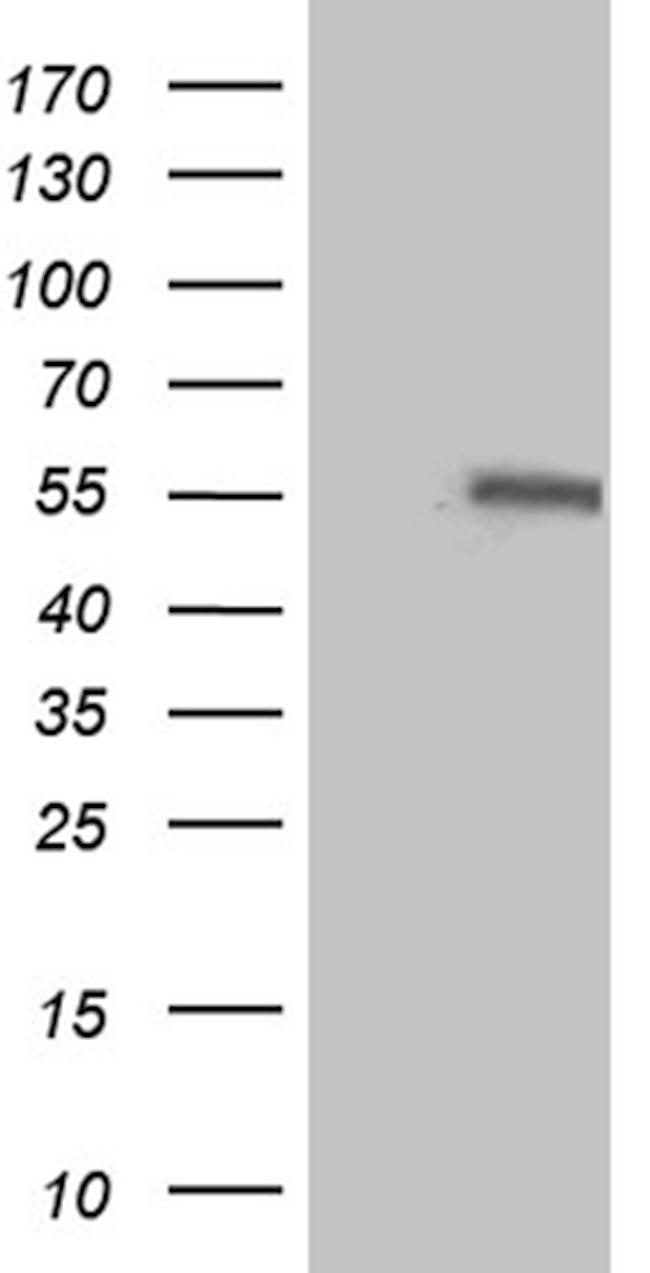 IL15RA Antibody in Western Blot (WB)