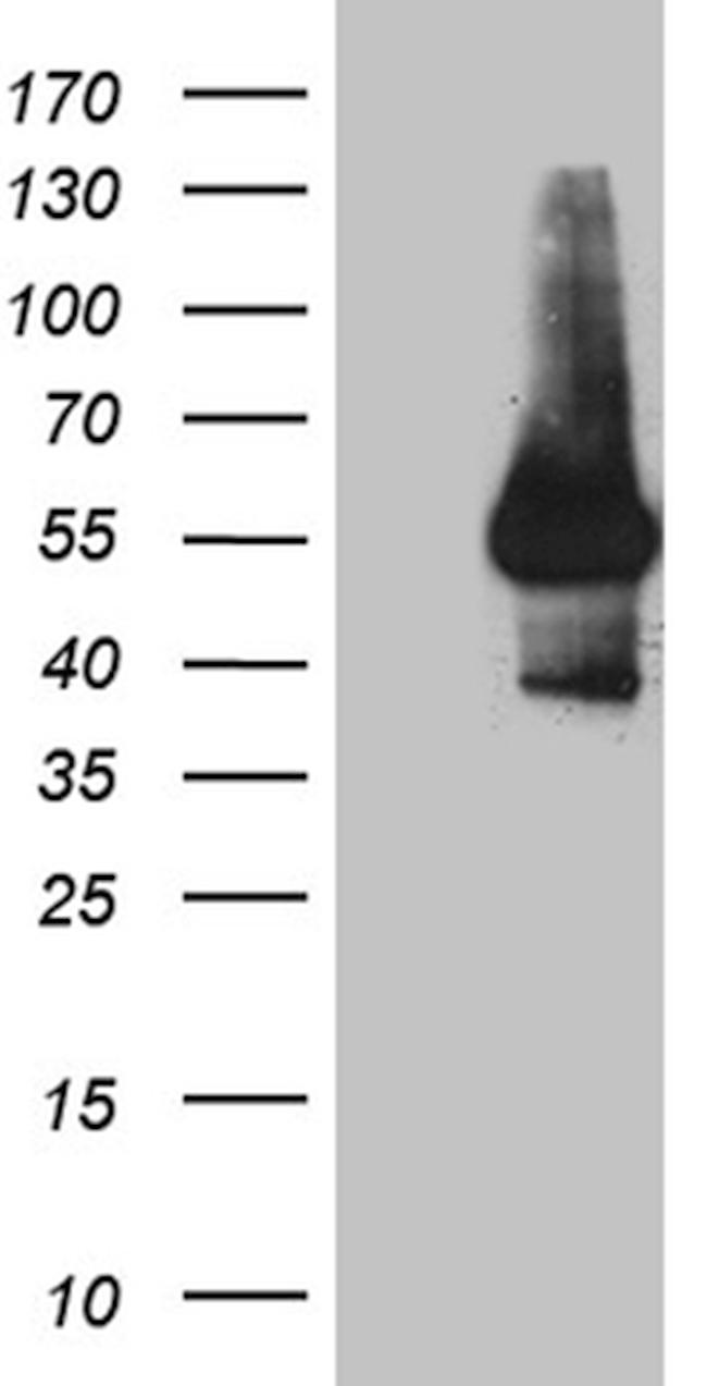 IL15RA Antibody in Western Blot (WB)