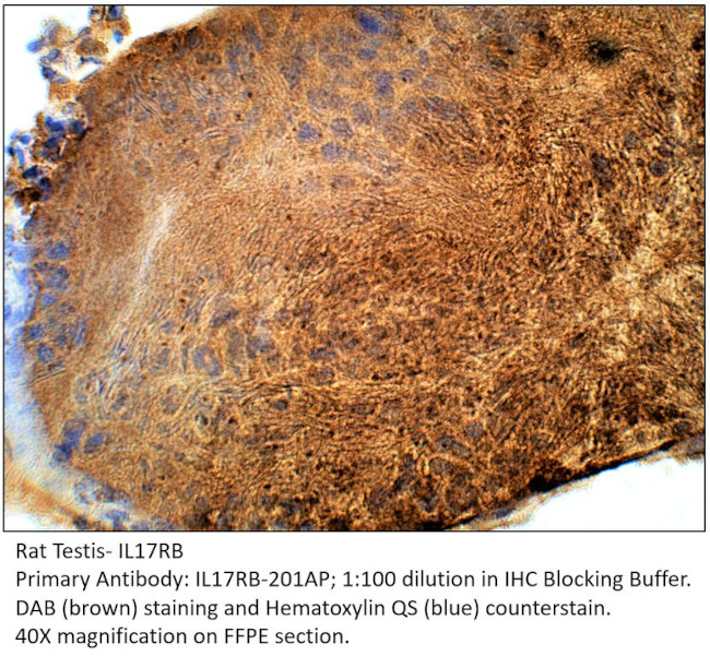 IL17RB Antibody in Immunohistochemistry (IHC)