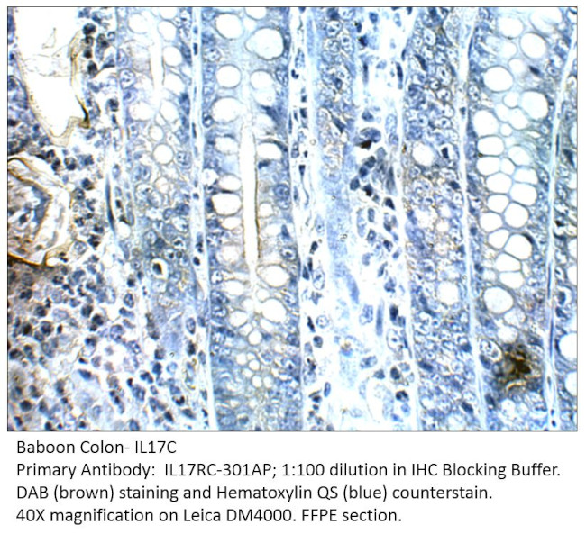 IL17C Antibody in Immunohistochemistry (IHC)