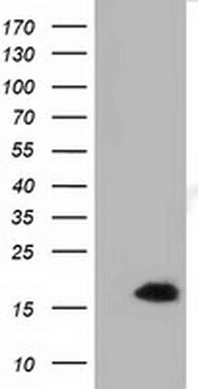 IL1F6 Antibody in Western Blot (WB)