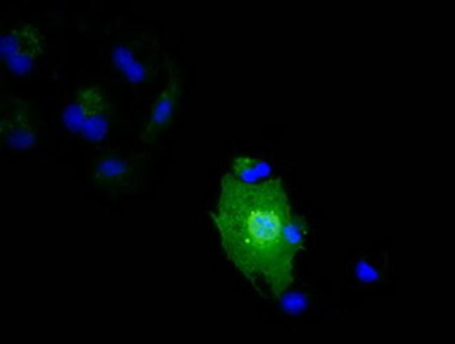 IL1F6 Antibody in Western Blot (WB)