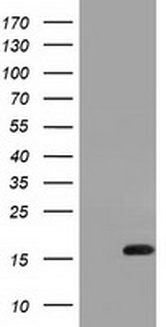 IL1F6 Antibody in Western Blot (WB)