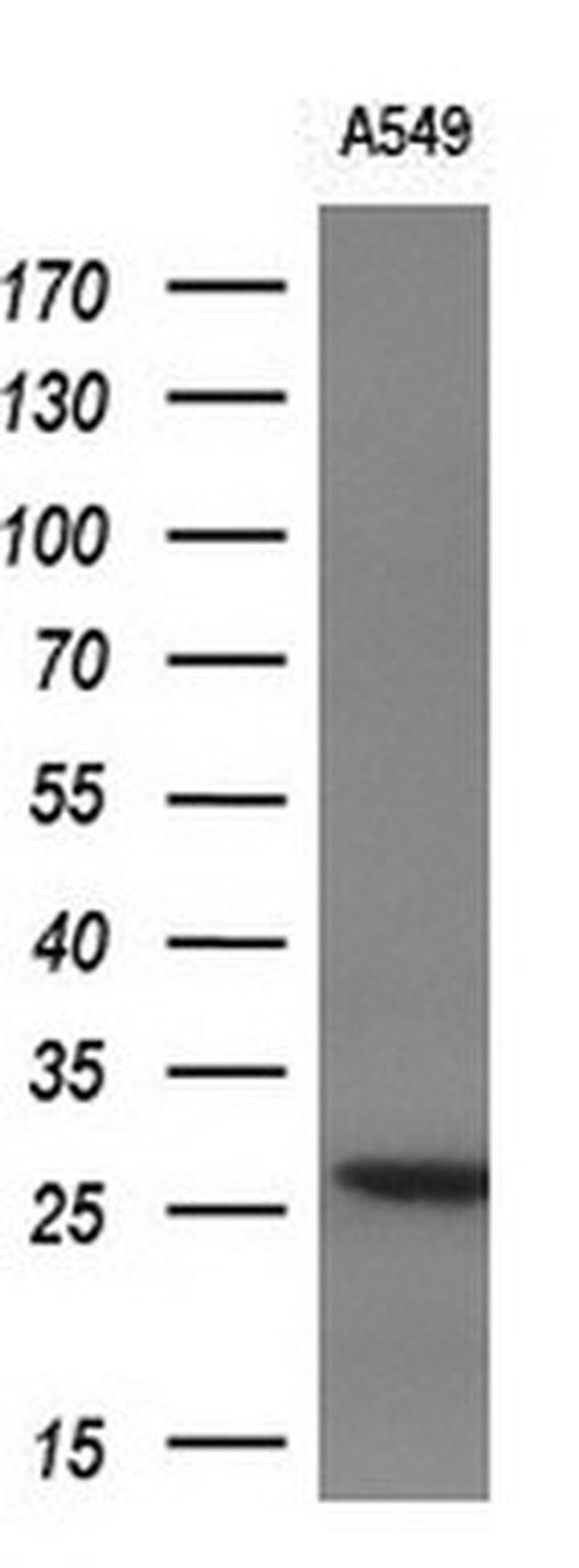 IL1F6 Antibody in Western Blot (WB)