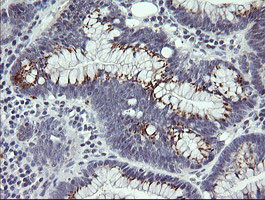 IL1F9 Antibody in Immunohistochemistry (Paraffin) (IHC (P))