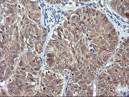 IL1F9 Antibody in Immunohistochemistry (Paraffin) (IHC (P))