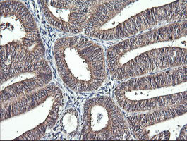 IL1F9 Antibody in Immunohistochemistry (Paraffin) (IHC (P))