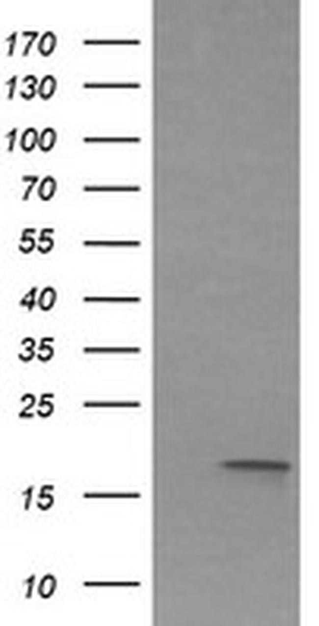 IL1F9 Antibody in Western Blot (WB)