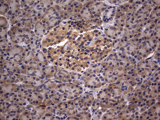 IL1RN Antibody in Immunohistochemistry (Paraffin) (IHC (P))