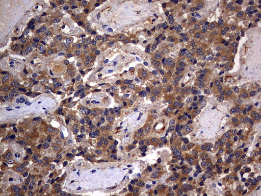 IL1RN Antibody in Immunohistochemistry (Paraffin) (IHC (P))