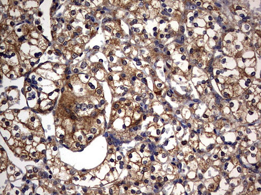 IL1RN Antibody in Immunohistochemistry (Paraffin) (IHC (P))