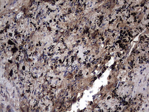 IL1RN Antibody in Immunohistochemistry (Paraffin) (IHC (P))