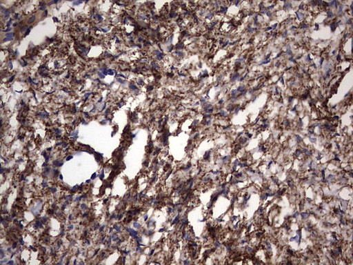 IL1RN Antibody in Immunohistochemistry (Paraffin) (IHC (P))