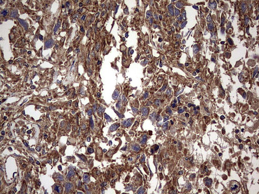 IL1RN Antibody in Immunohistochemistry (Paraffin) (IHC (P))