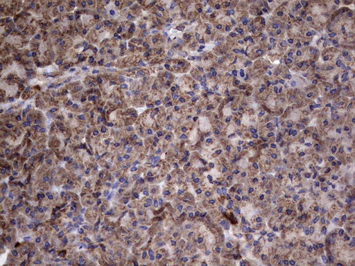 IL1RN Antibody in Immunohistochemistry (Paraffin) (IHC (P))