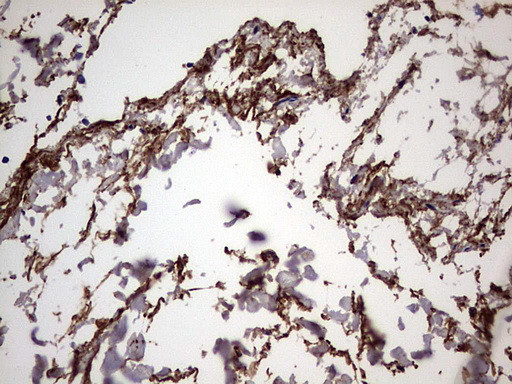 IL1RN Antibody in Immunohistochemistry (Paraffin) (IHC (P))