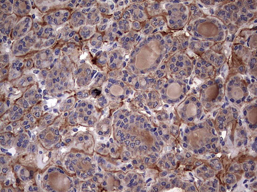 IL1RN Antibody in Immunohistochemistry (Paraffin) (IHC (P))