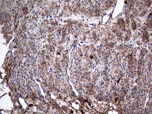 IL1RN Antibody in Immunohistochemistry (Paraffin) (IHC (P))