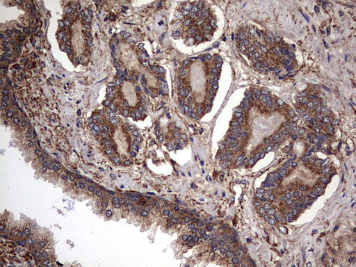 IL1RN Antibody in Immunohistochemistry (Paraffin) (IHC (P))