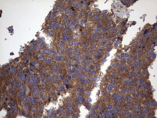 IL1RN Antibody in Immunohistochemistry (Paraffin) (IHC (P))