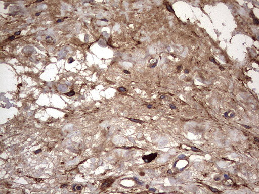 IL1RN Antibody in Immunohistochemistry (Paraffin) (IHC (P))