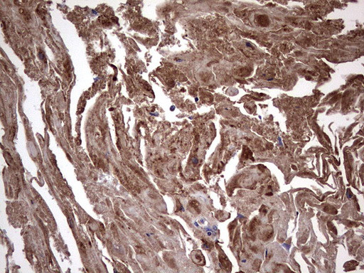 IL1RN Antibody in Immunohistochemistry (Paraffin) (IHC (P))