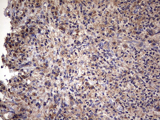 IL1RN Antibody in Immunohistochemistry (Paraffin) (IHC (P))