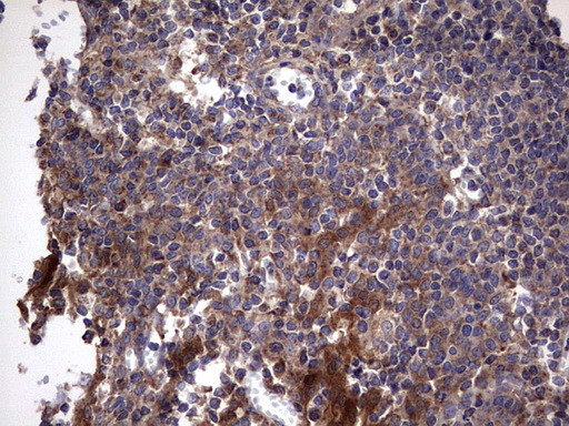 IL1RN Antibody in Immunohistochemistry (Paraffin) (IHC (P))