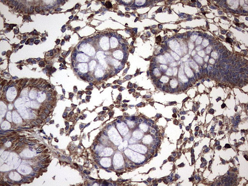 IL1RN Antibody in Immunohistochemistry (Paraffin) (IHC (P))