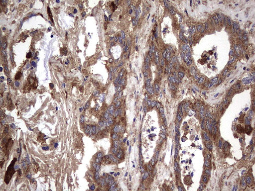 IL1RN Antibody in Immunohistochemistry (Paraffin) (IHC (P))