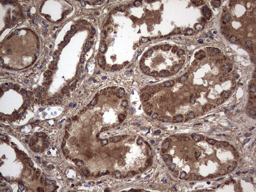 IL1RN Antibody in Immunohistochemistry (Paraffin) (IHC (P))