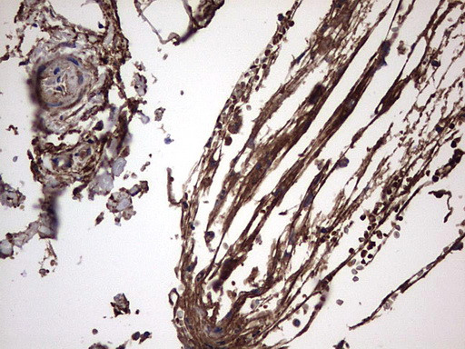 IL1RN Antibody in Immunohistochemistry (Paraffin) (IHC (P))