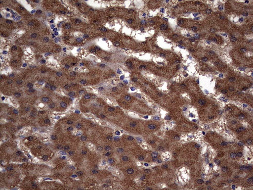 IL1RN Antibody in Immunohistochemistry (Paraffin) (IHC (P))