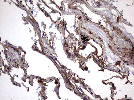 IL1RN Antibody in Immunohistochemistry (Paraffin) (IHC (P))