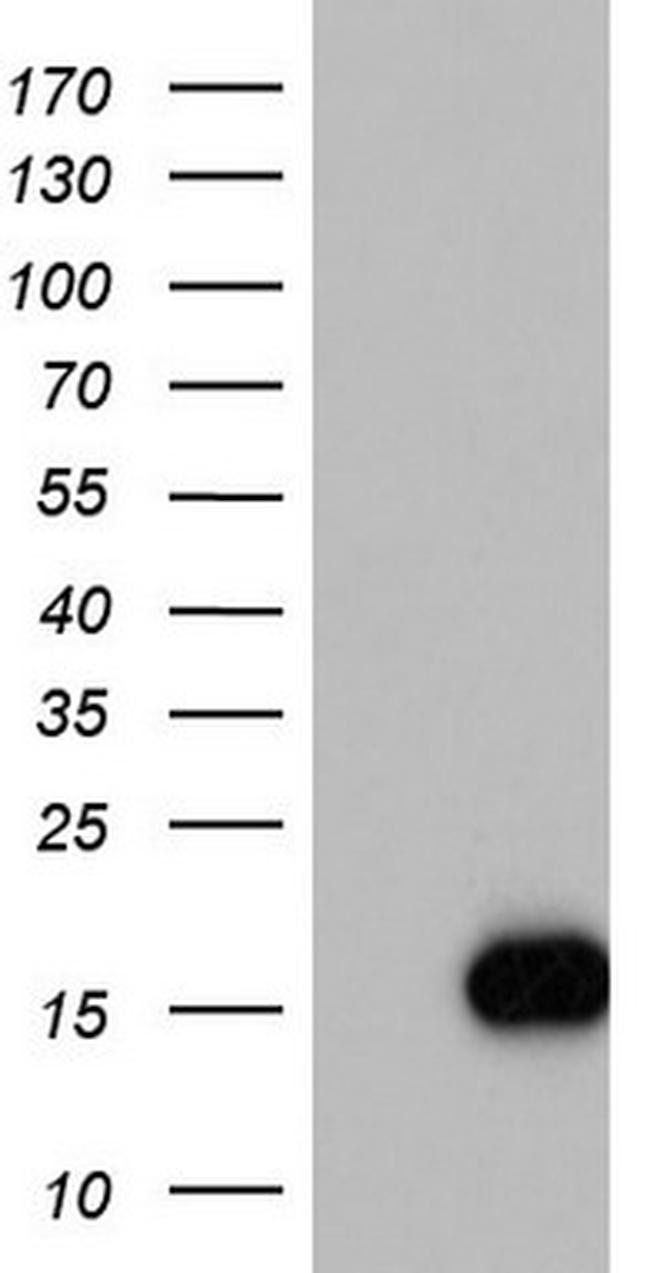 IL1RN Antibody in Western Blot (WB)