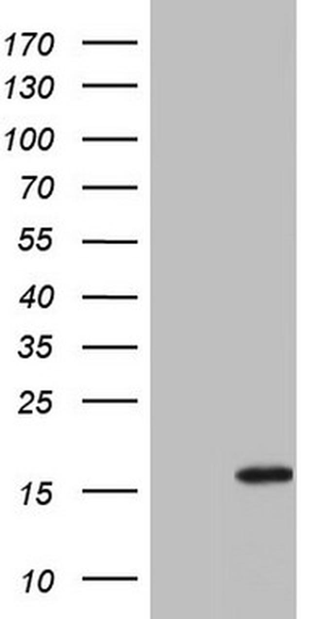 IL1RN Antibody in Western Blot (WB)