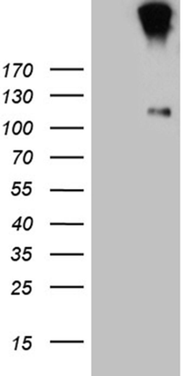 IL20RA Antibody in Western Blot (WB)