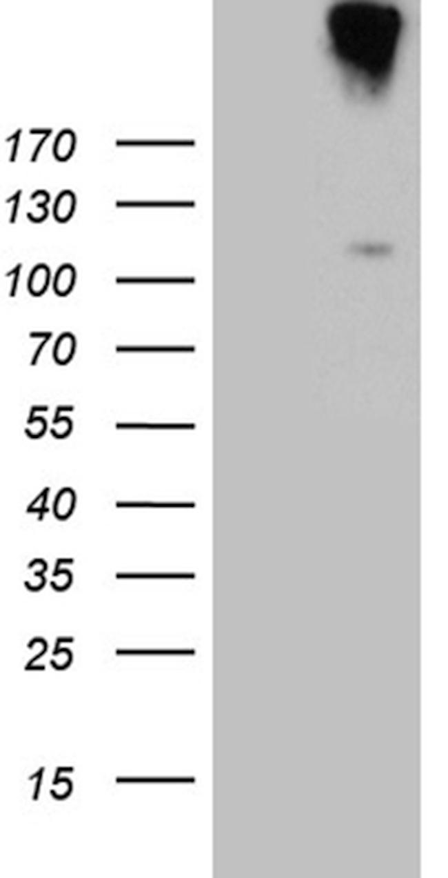 IL20RA Antibody in Western Blot (WB)