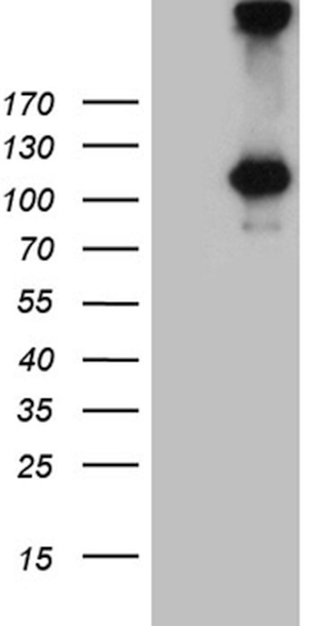 IL20RA Antibody in Western Blot (WB)